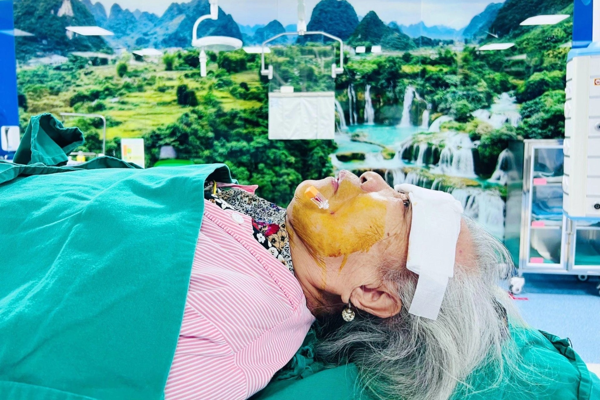 Tiêm cồn diệt hạch Gasser - Thoát đau dây thần kinh số 5 đeo bám suốt 1 năm