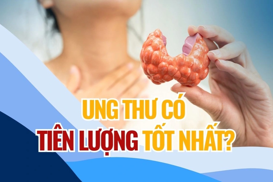 Hiểu đúng về loại ung thư thường được đánh giá có tiên lượng tốt