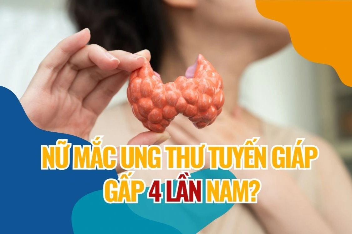 Giải mã lý do nữ giới mắc ung thư tuyến giáp cao gấp 4 lần nam giới