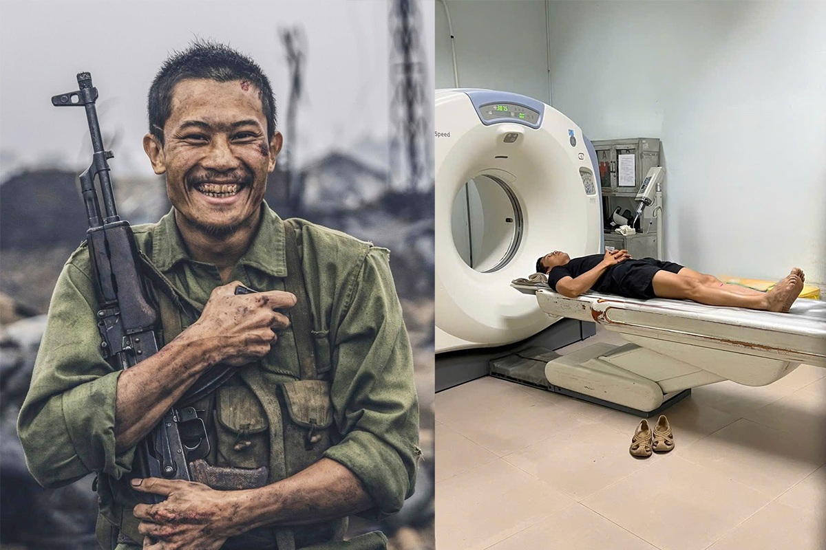 Diễn viên Phương Nam gặp tai nạn khi quay phim, bị chấn thương đầu