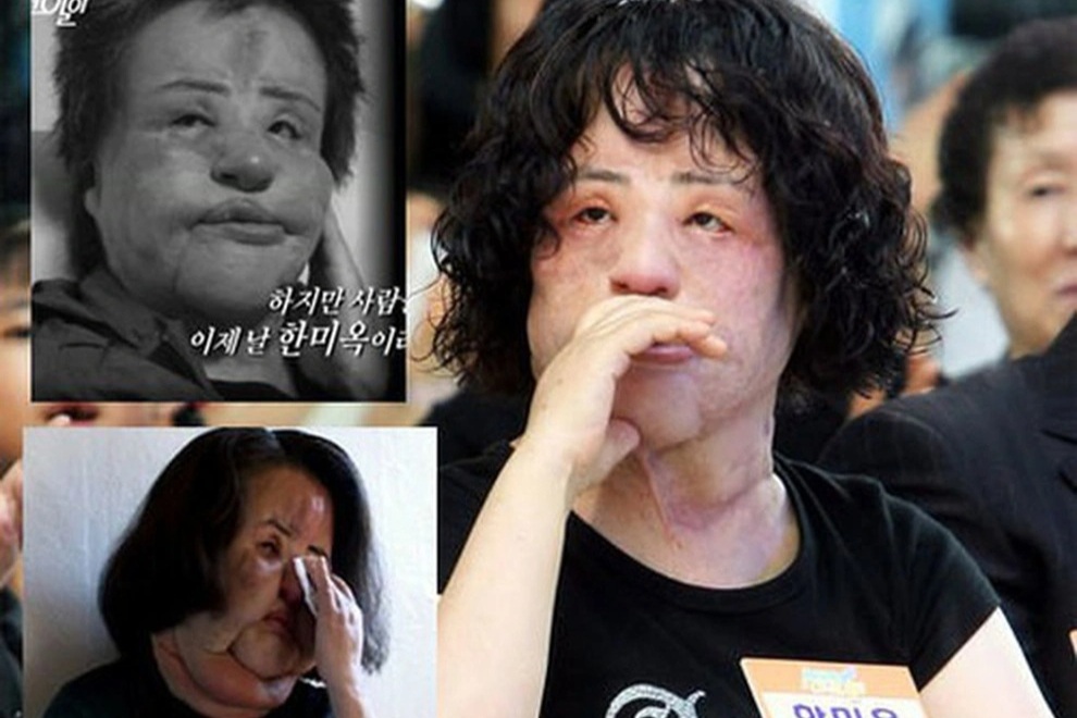 Bi kịch của biểu tượng nhan sắc Hàn hủy hoại cuộc đời vì phẫu thuật thẩm mỹ