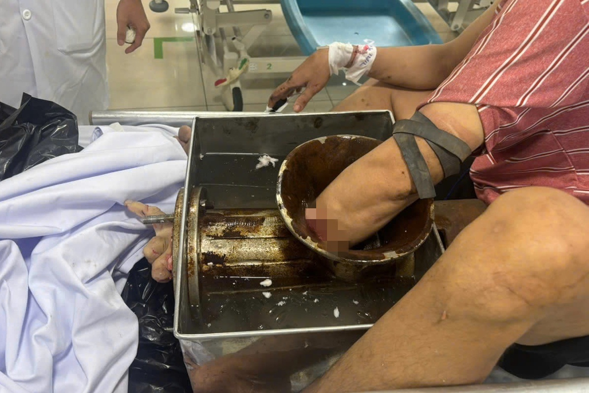 TPHCM: Người đàn ông gặp tai nạn thương tâm tại xưởng chế biến thịt heo xay