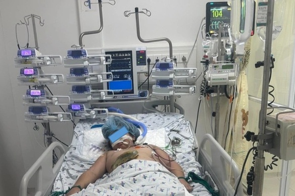 Hành trình 6 tháng cứu bé gái lóc da hiếm gặp do tai nạn giao thông