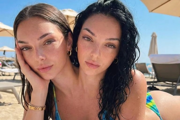 Mỹ: Sự thật về cặp song sinh dính liền thân, có gương mặt xinh đẹp gây sốt