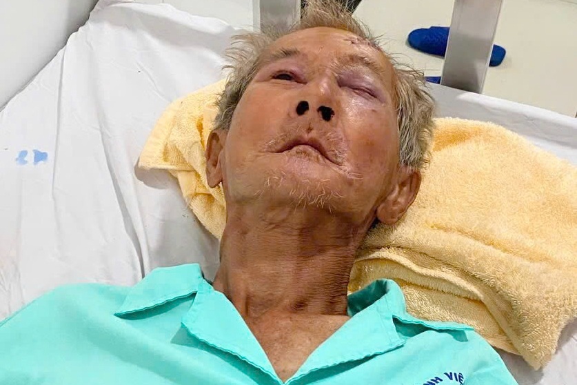 Tìm thân nhân người đàn ông đang điều trị tại bệnh viện ở Tây Ninh