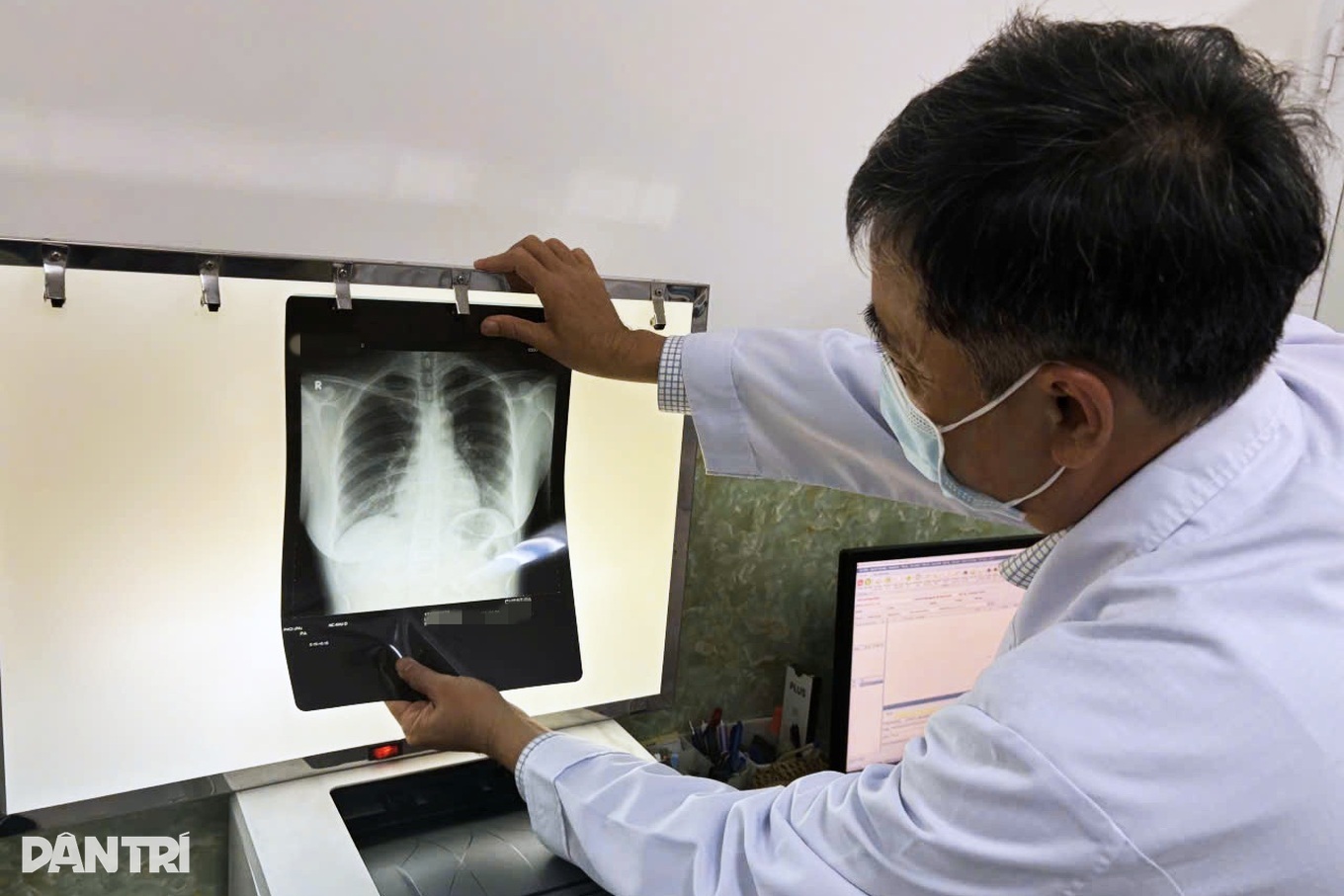 Hiểu đúng về thời gian chụp X-quang ở bệnh viện