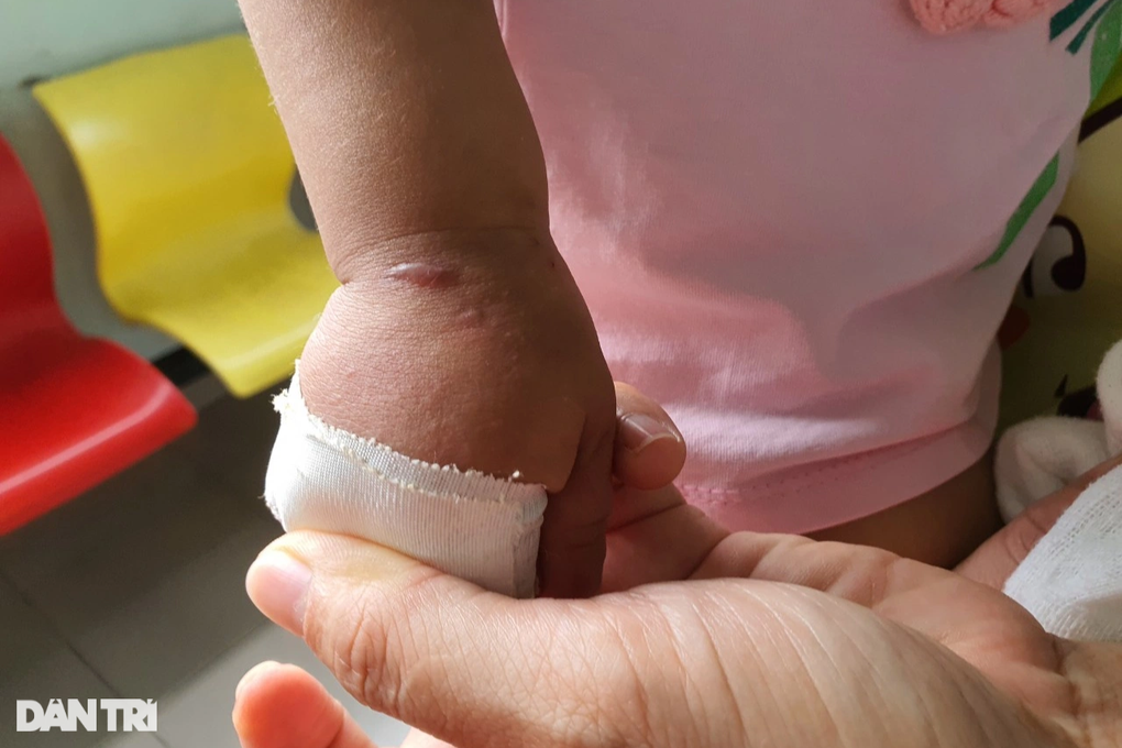 Gánh nặng bệnh hiếm - chẩn đoán khó, chi phí điều trị cao