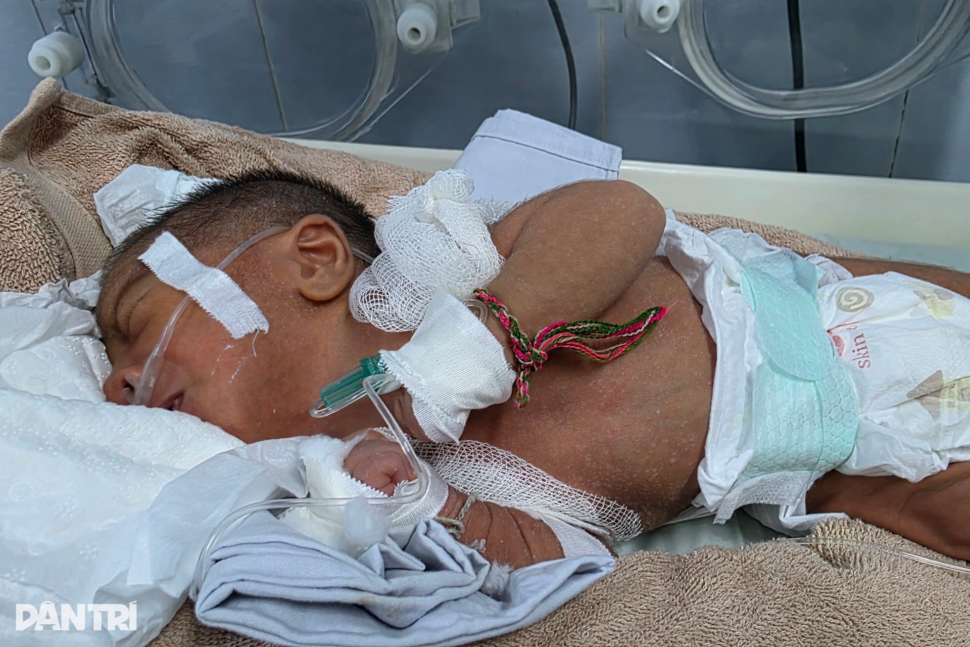 Bác sĩ kêu gọi bạn đọc cứu bé sơ sinh nguy kịch tính mạng