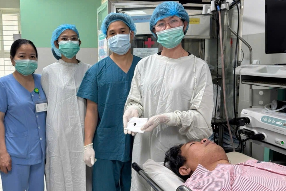 Ho 4 tháng không khỏi, phát hiện hạt hồng xiêm mắc trong phế quản