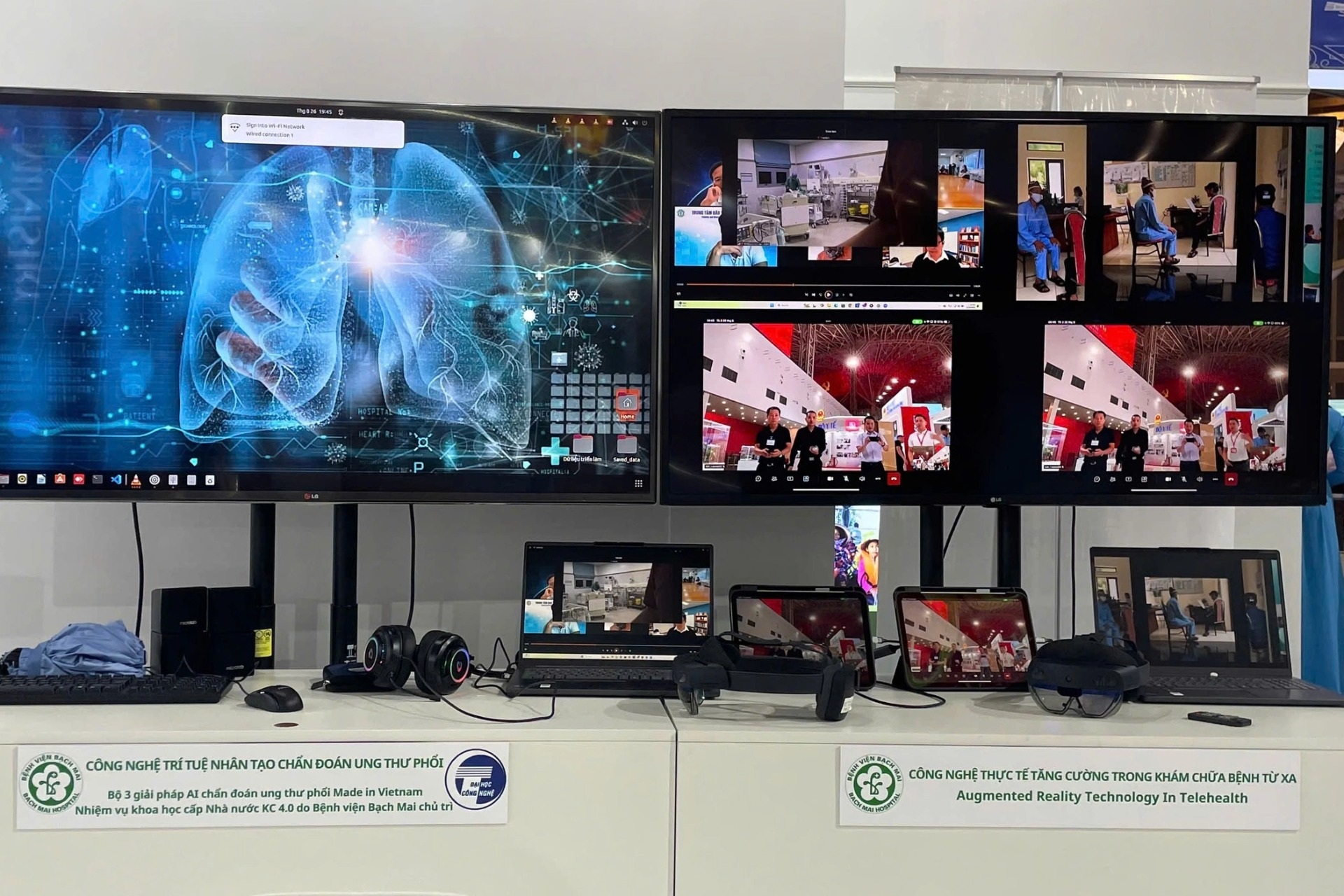 "Mắt thần AI" vượt qua bài kiểm tra với bác sĩ phát hiện sớm ung thư phổi