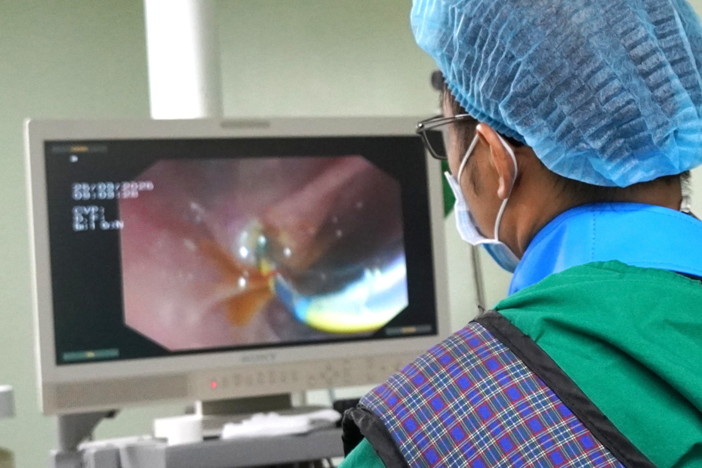 Nuốt xương cá, người đàn ông bất ngờ bị dị vật “chui” vào gan