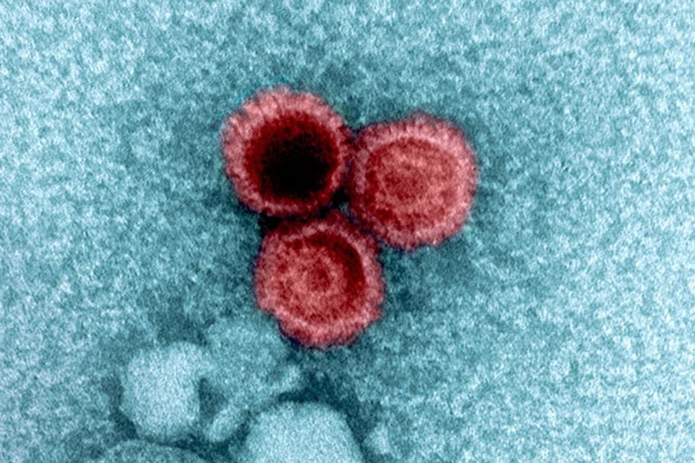 Nghiên cứu hé lộ lý do một số virus ẩn náu bên trong cơ thể bạn suốt đời