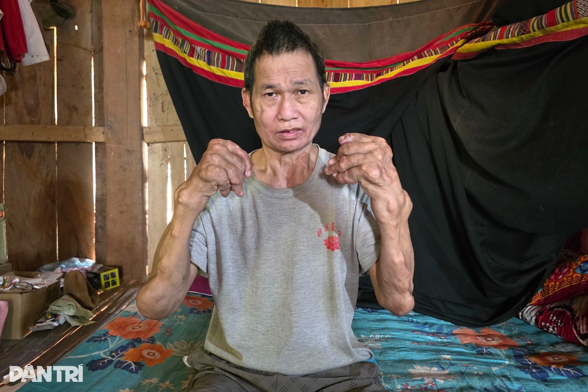 Lao động chính nằm liệt giường, toàn thân nổi cục, gia đình nghèo kiệt quệ