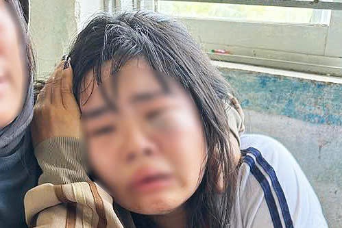 Nữ sinh bị đánh tới tấp trước cổng trường có dấu hiệu hoảng loạn, nôn ói