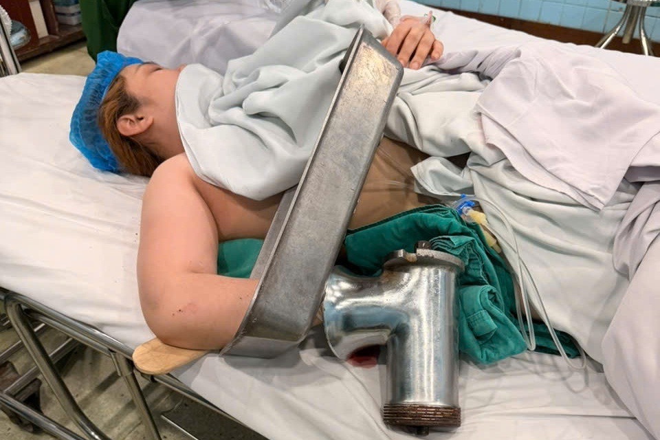 TPHCM: Xay thịt 21 năm ở chợ, người phụ nữ mất bàn tay trong một phút lơ là