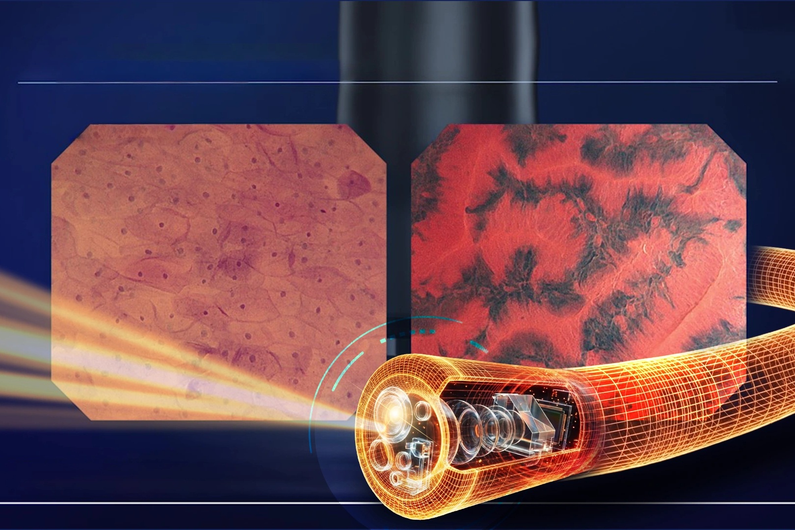 Endocyto 520x: Vai trò trong chẩn đoán và định hướng phát triển nội soi tiêu hóa