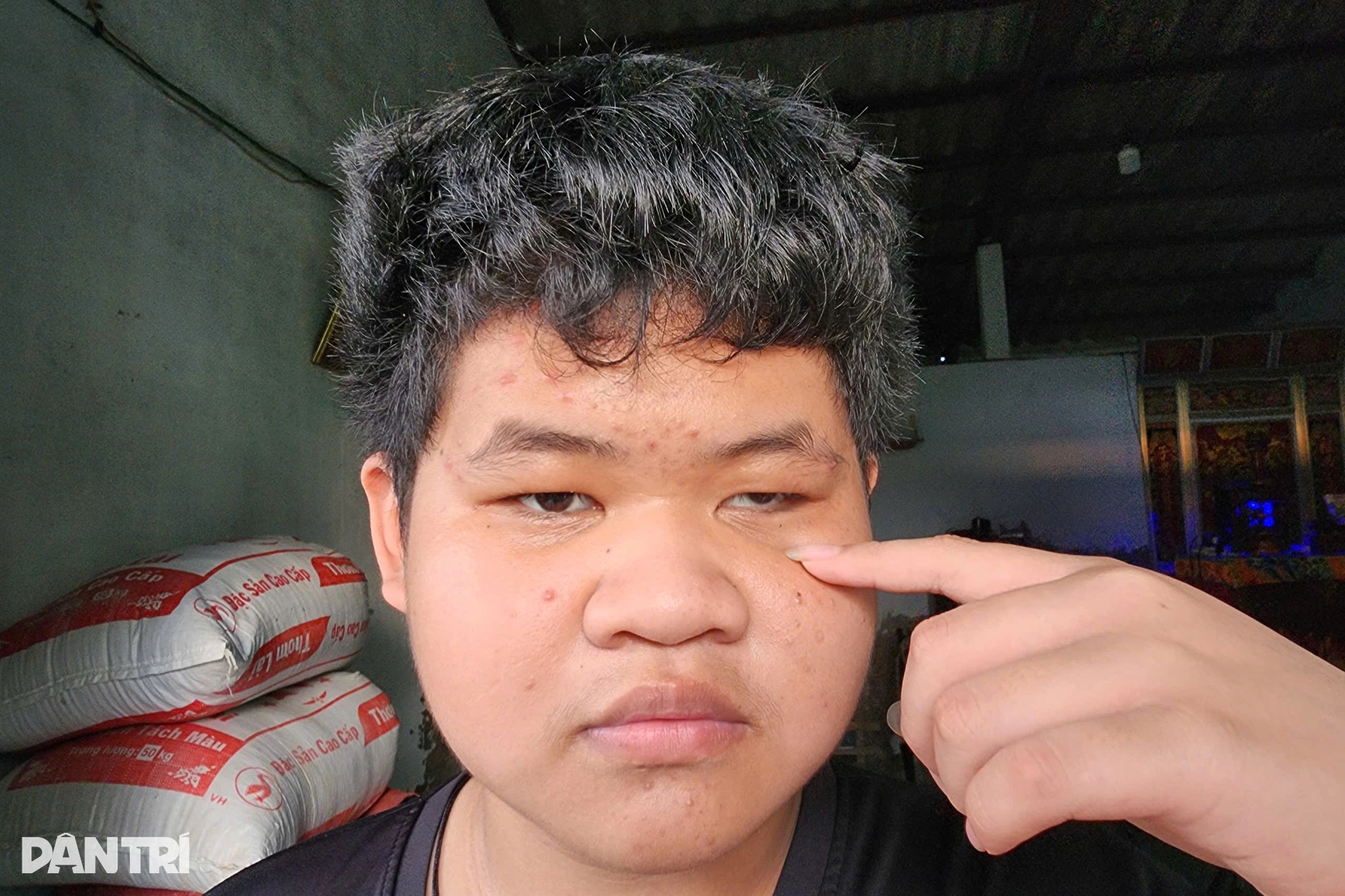 Bé trai ung thư, mù một mắt, gia đình nghèo kiệt sức sau 9 năm