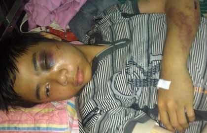 Hành hung học sinh lớp 8, thượng sĩ công an bị đình chỉ