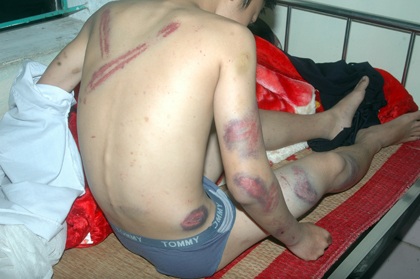 Hành hung học sinh lớp 8, thượng sĩ công an bị đình chỉ