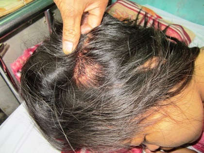 Vợ chồng thai phụ tố CSGT ra gậy phản ứng về kết luận phía Công an