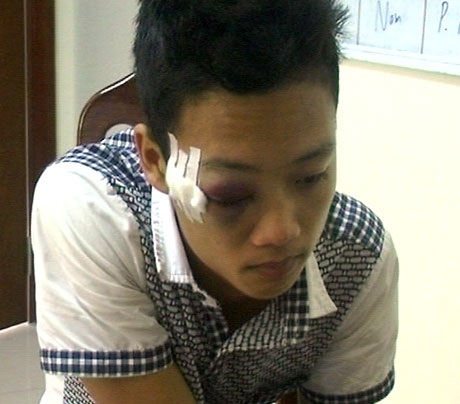 Đối tượng Dương Văn Lực bị bắt. (Ảnh: Báo Quảng Ninh)