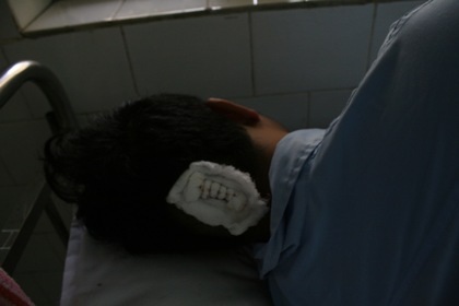 Một nạn nhân vụ nổ súng đang được điều trị tại bệnh viện.