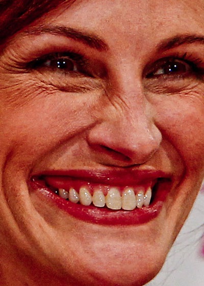 Choáng với ảnh cận mặt “bóc mẽ” các ngôi sao