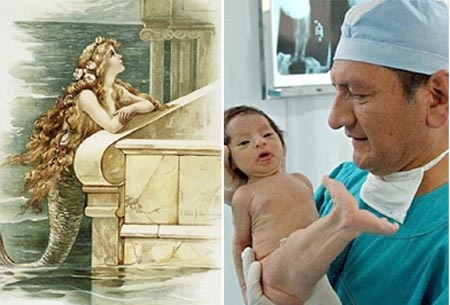 Giải mã hiện tượng nàng tiên cá trong đời thực - 1 Giải mã hiện tượng nàng tiên cá trong đời thực