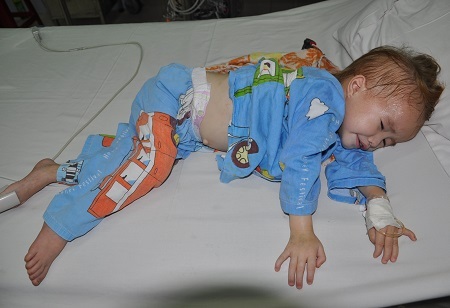 Hình ảnh đáng thương của em trước khi được mổ.