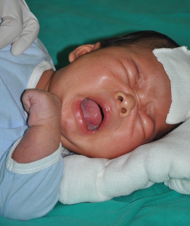 Tai nạn bỏng của con do lỗi của mẹ đã để em nằm một mình.