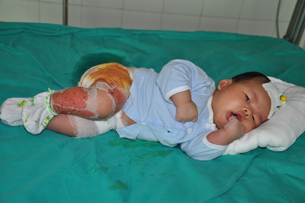 ...Vì sự bất cẩn của mình nên đã dẫn đến tai nạn của con.