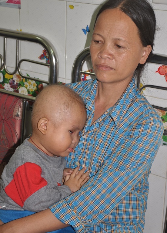 Nam Phong sau hơn 2 tháng điều trị ở viện K, tóc đã rụng đi nhiều.