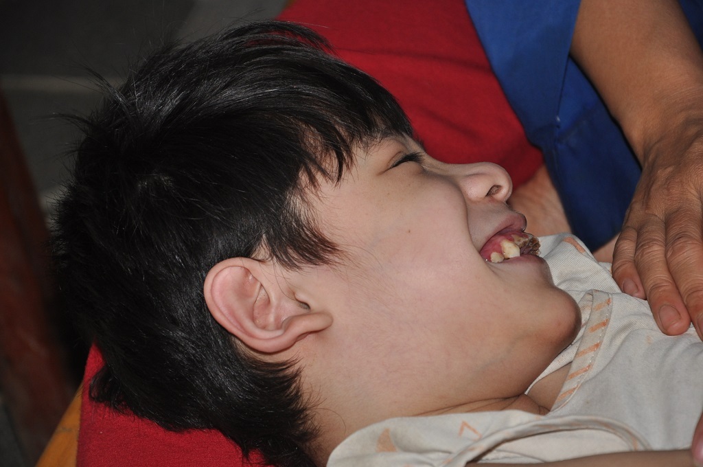 13 tuổi nhưng cậu bé Thảo bị bại não nên không nhận biết được điều gì.