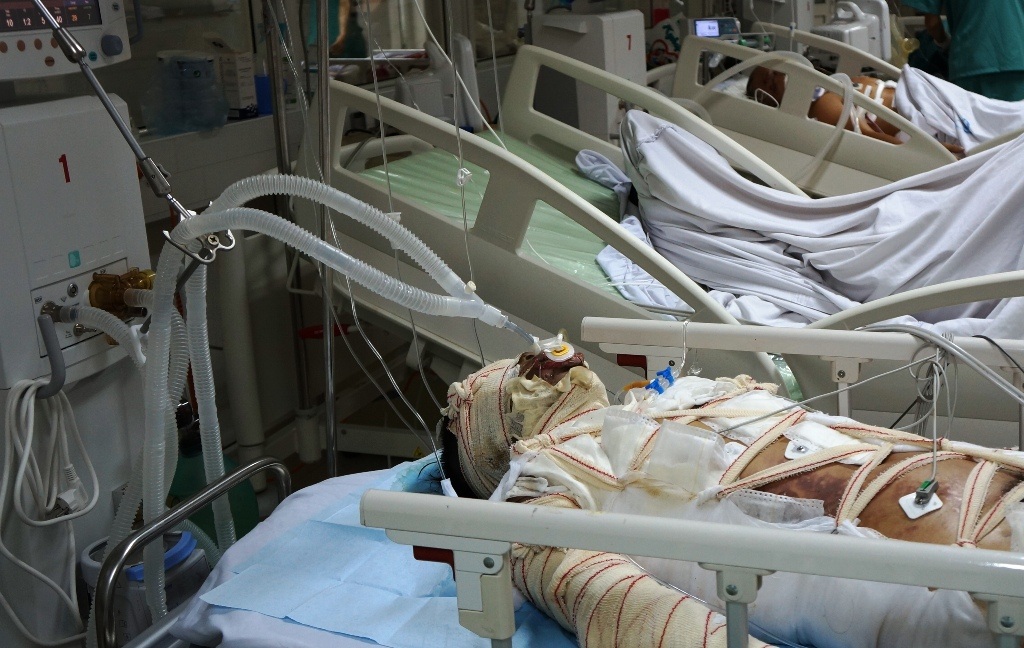 Bị bỏng xăng đến 80% cơ thể, hiện tính mạng của chị Danh đang hết sức nguy kịch.