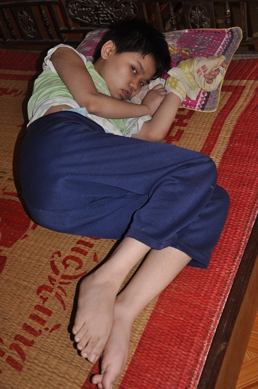 Đã 13 tuổi nhưng Quỳnh không biết gì, chân tay co quắp không đi lại được.