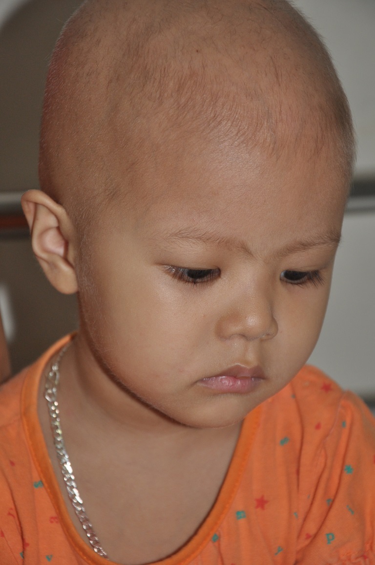 Đang điều trị hóa chất đợt 4, sức khỏe của Linh khá ổn nên em chơi ngoan.