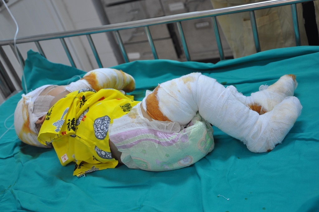 Nhìn cháu, chị Nga ngẹn lời kể chuyện gia đình.