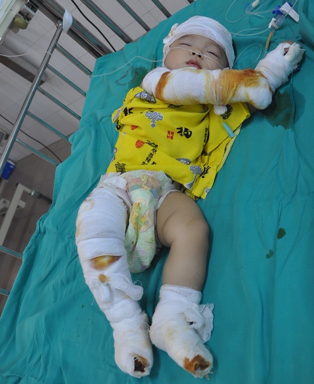 Chị Duyên thi thoảng tỉnh lại là vội vàng hỏi chồng và các con.