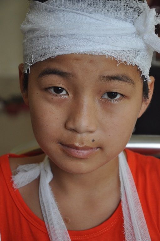 Hiện tình trạng của bé Tùng đã khá hơn nhiều.