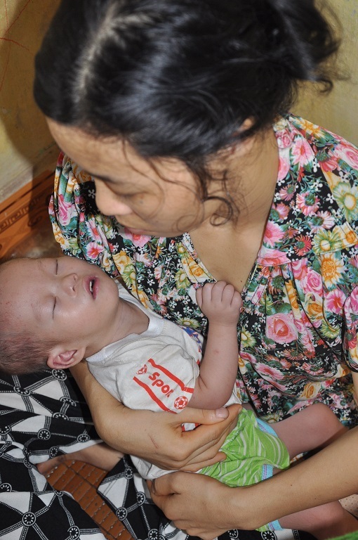 Bị tim bẩm sinh nên dù đã 20 tháng nhưng bé Trường chỉ nặng 6kg.