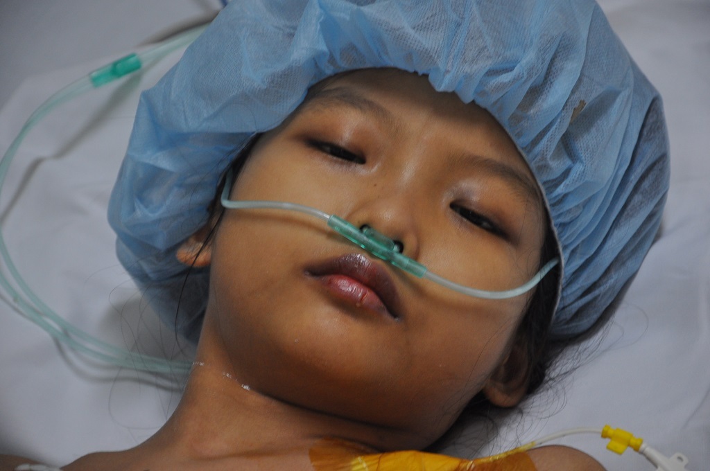 Bị suy tim nặng ở giai đoạn 4, tính mạng của bé Mai như ngọn đèn trước gió.