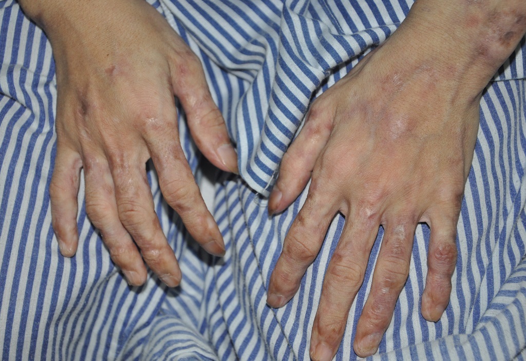 Đôi bàn tay nhăn nheo, thô kệch.