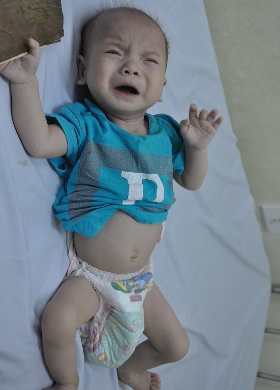 Hiện tính mạng của bé Đạt đang bị đe dọa bởi chưa được tiến hành ca mổ.