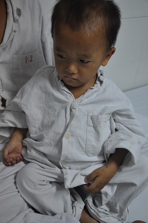 Bé Trông tội nghiệp, đáng thương đến viện khi căn bệnh đã quá nặng.