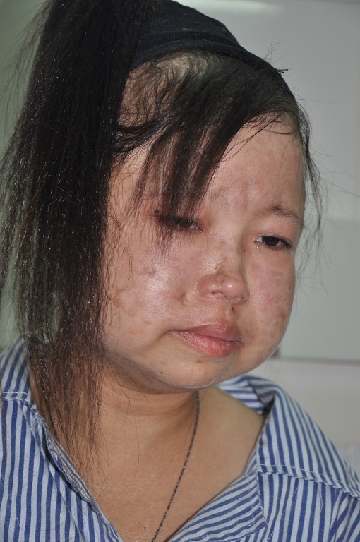 Em đau đớn khi nghĩ đến cảnh mình phải chết vì mẹ không có tiền chữa bệnh.