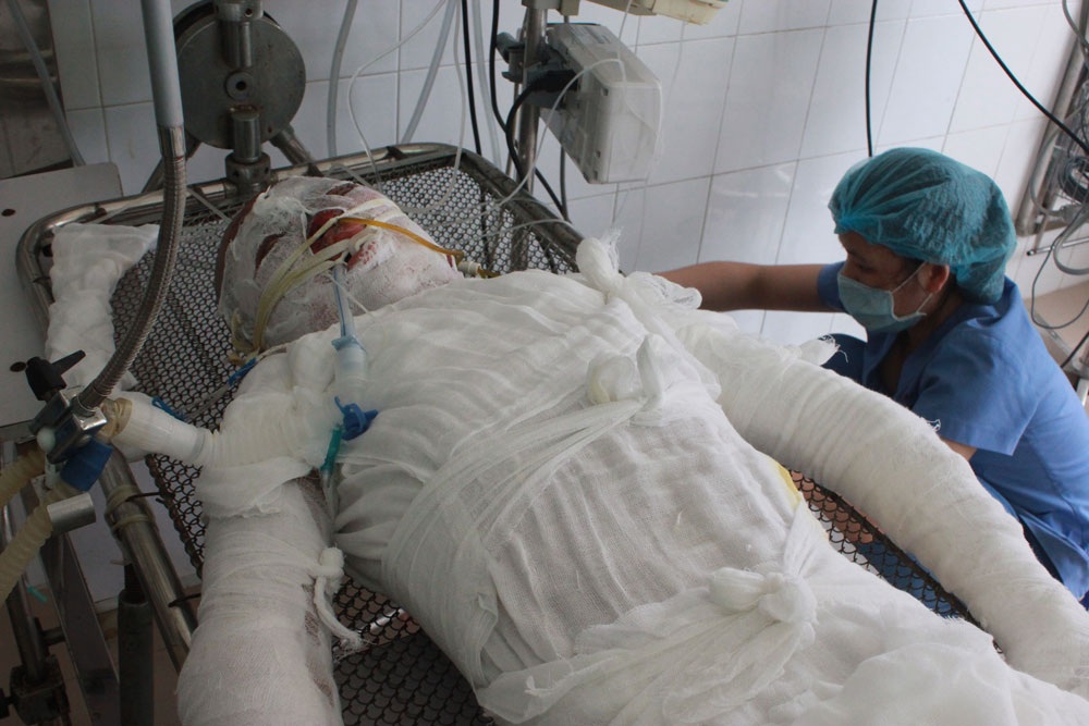 Hơn 65 triệu đến với gia đình bé Tuấn Anh bị bỏng khi đi câu cá