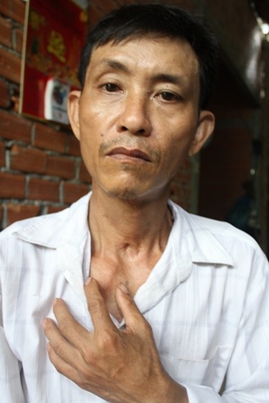 Sức khỏe ông Bùi ngày càng giảm sút sau khi mắc ung thư tuyến giáp