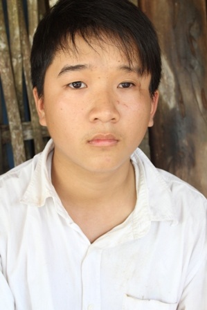 Mắt trái của Nghị bị mù giờ có triệu chứng lây sang cả mắt phải