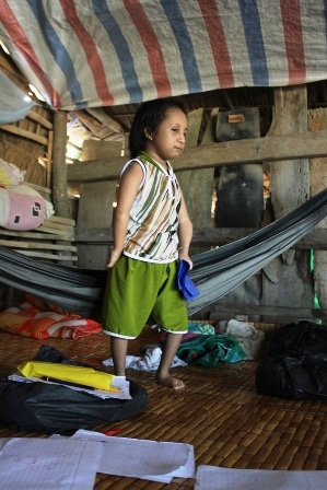 Bé 12 tuổi chỉ bằng đứa trẻ khoảng 2 tuổi