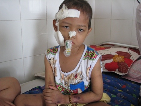 Cháu Bảo đang điều trị tại Bệnh viện Phụ sản – Nhi Đà Nẵng với căn bệnh ung thư máu